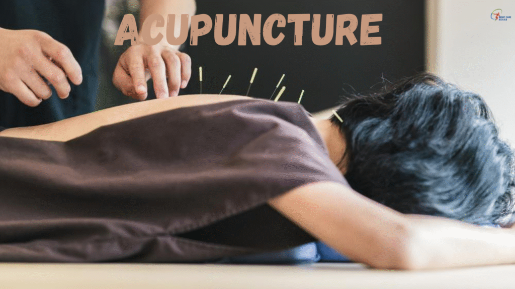 ACUPUNCTURE