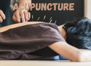 ACUPUNCTURE ACUPUNCTURE