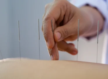 acupuncture-therapy-muscle-tension-intro-mississauga Muscle Tension